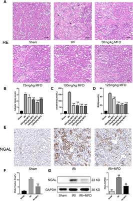 Corrigendum: Protective effects of Mefunidone on ischemia-reperfusion injury/folic acid-induced acute kidney injury